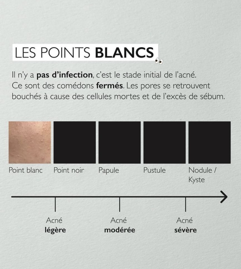 soin-bronzant-estheticienne roquebrune sur argens-extensions de cils frejus-soins du visage saint raphael-massages puget sur argens-ongles en gel le muy-bronzage sainte maxime-epilation le plan de la tour-epilation pour hommes saint tropez-estheticienne a domicile la motte