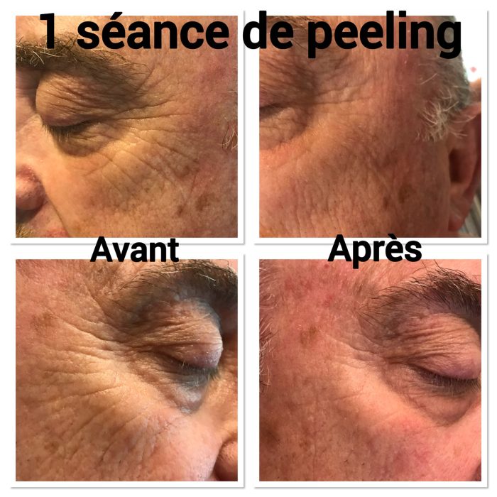 soin-bronzant-estheticienne roquebrune sur argens-extensions de cils frejus-soins du visage saint raphael-massages puget sur argens-ongles en gel le muy-bronzage sainte maxime-epilation le plan de la tour-epilation pour hommes saint tropez-estheticienne a domicile la motte
